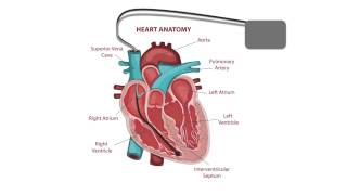 Pacemaker Issues Explained Part 2 Decoding Undersensing [upl. by Scharff846]