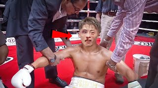 Holy sht NAOYA INOUE Like Never Before [upl. by Gregorius734]