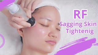 RF FACIAL NON SURGICAL FACELIFT  HOW TO USE RADIO FREQUENCY  FACE SKIN TIGHTENING TREATMENT 1391 [upl. by Arabella]