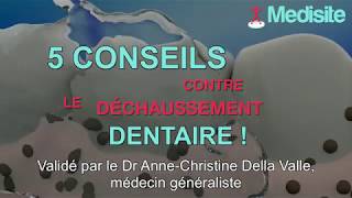 5 conseils contre le déchaussement dentaire [upl. by Giule]