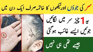 Anti Lice Treatment At Home  Juain Khatam Karne Ka Tarika  Jowon Ka Khatma [upl. by Siegfried493]