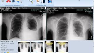 CARESTREAM Vue for Radiology Image Display [upl. by Raual]