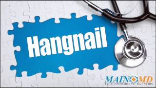 Hangnail ¦ Treatment and Symptoms [upl. by Koppel]