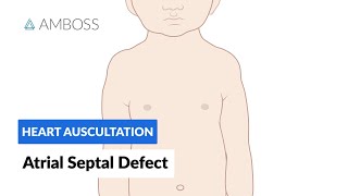 Atrial Septal Defect  Heart Auscultation  Episode 7 [upl. by Essyla]