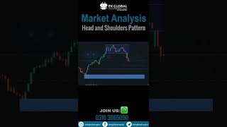 Head and Shoulders Pattern [upl. by Ramah]