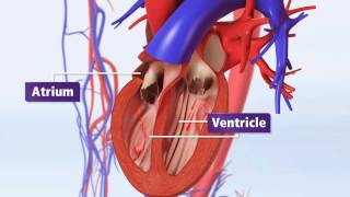 Atrial Fibrillation Animation Explained AFib amp Risk of Stroke [upl. by Berghoff]