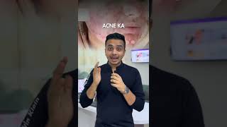 Debunking Pimple Myths 🚫 Dont believe everything you hear about acne treatments [upl. by Bonnette]