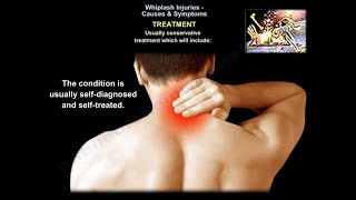 Whiplash Injuries Causes amp Symptoms  Everything You Need To Know  Dr Nabil Ebraheim [upl. by Ahsiniuq]