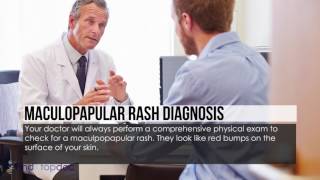 What Is a Maculopapular Rash [upl. by Tacye808]