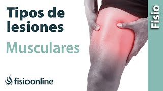 Tipos o grados de LESIONES MUSCULARES y su tratamiento y recuperación [upl. by Curren]