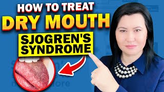 Sjogrens Syndrome Dry Mouth Treatment Options [upl. by Lewellen]