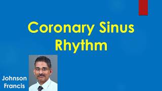 Coronary Sinus Rhythm [upl. by Nathanson]