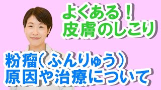 よくある皮膚のしこり粉瘤（ふんりゅう）の原因と治療【公式 やまぐち呼吸器内科・皮膚科クリニック】 [upl. by Etnaid]