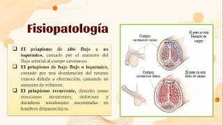 Priapismo [upl. by Kerwon]