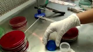 Sputum Culture Procedure Microbiology  bacteriology sputum culture [upl. by Hsina896]