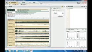 PULSE Reflex Core – Time recording analysis and report – Brüel amp Kjær [upl. by Mccreary]