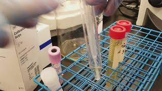 Urinalysis Preparing the 3 patient urine specimens for microscopic analysis [upl. by Akienom406]