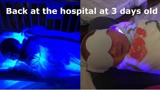 High Bilirubin Emergency amp Hospital stay with a 3 day old [upl. by Leile397]