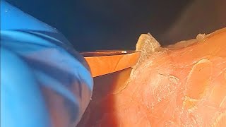 How to Remove Dead Skin from Feet [upl. by Zoie560]