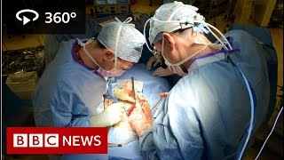 In 360 Oesophageal cancer operation filmed  BBC News [upl. by Madelin48]