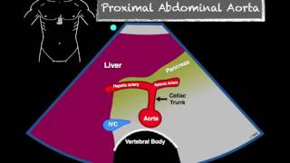 Bedside Ultrasound Abdominal Aorta [upl. by Babbette]