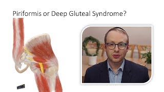 Piriformis Syndrome or Deep Gluteal Syndrome [upl. by Nataline]