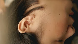 What is a perforated eardrum  Patient Explainers [upl. by Ahsial998]