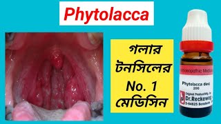 Phytolacca 200 Homeopathic Medicine Uses । Best Homeopathy Medicine for Tonsilitis । [upl. by Britte118]