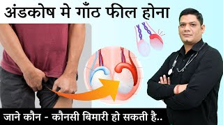 Epididymal Cyst Homeopathic Treatment  Causes Symptoms and Medicines  Dr Sunil Patidar [upl. by Annawad]