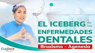 Bruxismo y Agenesia dental  Iceberg de las enfermedades dentales [upl. by Melitta]