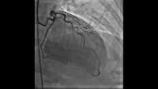 Myocardium  Definition Location amp Function  Human Anatomy  Kenhub [upl. by Mairhpe]