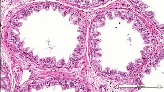 4 Histología Conductillos eferentes [upl. by Rihat999]