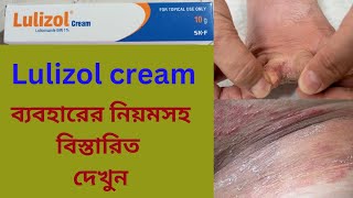 Lulizol Luliconazole Cream Bangla Lulizol cream কেন ব্যবহার করা হয় ব্যবহারের নিয়মসহ বিস্তারিত। [upl. by Hogarth]