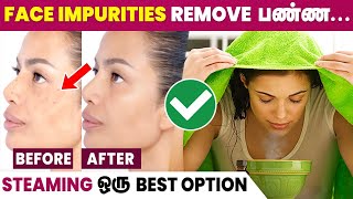 Benefits of Steaming Face  Glowing Skin at Home 😍 [upl. by Grinnell635]