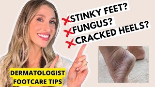 Footcare Tips for Cracked Heels Smelly Feet Toenail Fungus amp More  Dermatologist Dr Sam Ellis [upl. by Kuebbing]