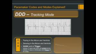 Pacemaker Codes and Modes  Explained [upl. by Nuawed262]