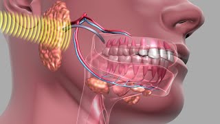 Oral Cancer Screening From Home  The Warning Signs Of Mouth Cancer [upl. by Forster501]