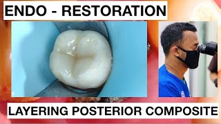 Step By Step Layering Composite Endo  Resto Molar [upl. by Amsed]