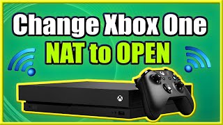 How to Change Xbox One NAT to OPEN and FIX Strict Connection Issues Easy Method [upl. by Lon]