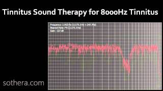 Tinnitus Sound Therapy for 8000Hz Tinnitus [upl. by Catton]