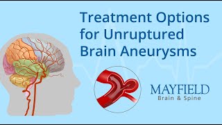 Treatment Options for Unruptured Brain Aneurysms [upl. by Sven531]