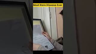 The Most Rare Disease In World 🤯  shorts facts [upl. by Ariaj]