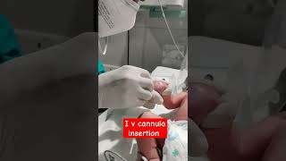 I v cannula insertion New born baby admission NICU care neonatal ❤️‍🩹🙏👏👍knowledgeable [upl. by Lou256]