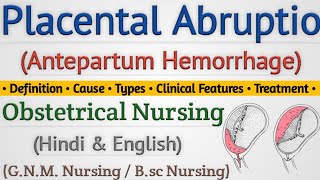 Placental Abruptio In Hindi  Abruptio Placenta क्या होता है  Antepartum Hemorrhage Lecture [upl. by Nazar]