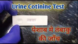 urine cotinine I cotinine urine test I tobacco test [upl. by Lemraj889]