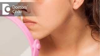 How to reduce swelling amp puffiness after nose surgery  Dr Srikanth V [upl. by Ahsilak435]