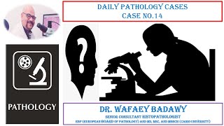 DAILY PATHOLOGY CASES CASE NO 14 BY DR WAFAEY BADAWY [upl. by Lahsiv]