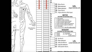 PostStroke Exercises Part 2 Lower Limb [upl. by Olinad14]