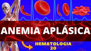 ANEMIA APLÁSICA ESTUDO DAS ANEMIAS  HEMATOLOGIA [upl. by Animehliw]