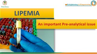 Lipemia An Important Pre analytical Issue in Lab [upl. by Lashonda]